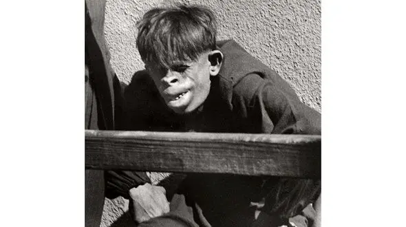 پسر نجیب زاده ای که شبیه به میمون های جنگلی زندگی می کند