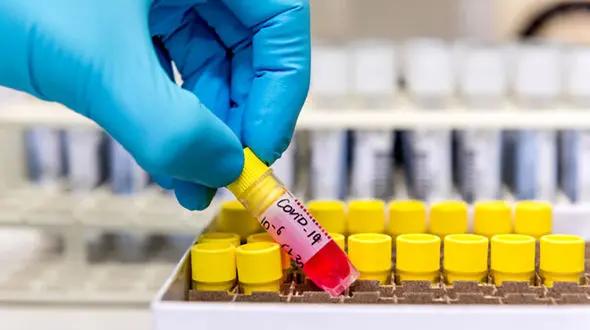 کرونا به پزشک باشگاه فوتبال هم رحم نکرد / او اولین قربانی لیگ جزیره است