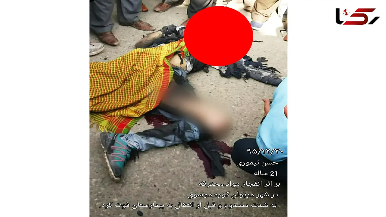 عکس وحشتناک از مرگ جوان 21 ساله با انفجار ترقه+عکس
