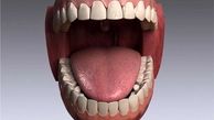 7 تا از بهترین روش‌های تقویت مینای دندان
