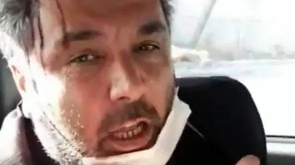 ماجرای حمله شهردار منطقه 9 تبریز به کارمند شهرداری/ وی خودزنی کرده است