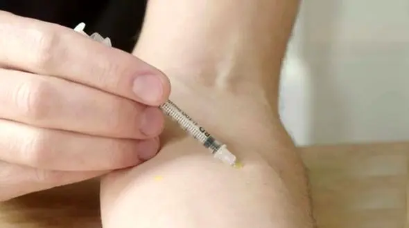 این مرد با سم مار زنده است! / او به خودس سم مار تزریق می‌کند+فیلم و عکس