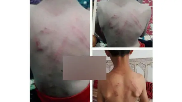 تصاویر دردناک از شکنجه هولناک یک کودک توسط معلم خوزستانی