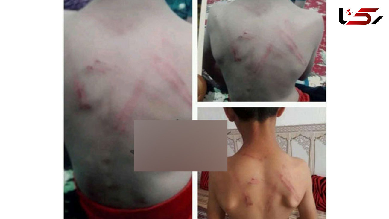 تصاویر دردناک از شکنجه هولناک یک کودک توسط معلم خوزستانی
