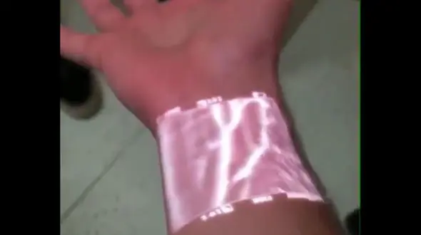 سرخرگ ها قابل رویت شدند + فیلم 