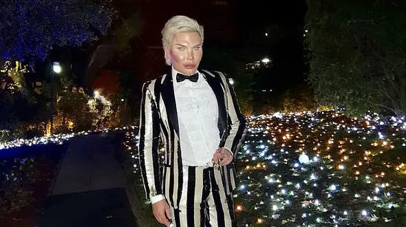 مرد عروسکی حاشیه ساز دوباره برای عمل جراحی به ایران آمد+ تصاویر
