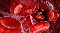 لخته شدن خون در رگ ها به چه عواملی بستگی دارد
