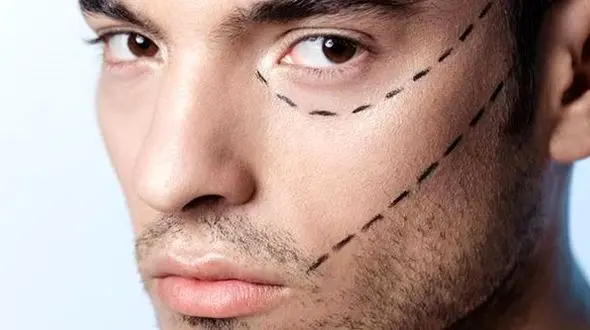 بازار بی سر و سامان قیمت گذاری عمل های زیبایی در ایران / کمیسیون بهداشت مجلس، وزارت بهداشت و سازمان نظام پزشکی ورود کنند