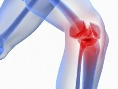 آیا دوچرخه‌ سواری به زانو آسیب می‌ زند؟ پاسخ یک فوق تخصص زانو + فیلم