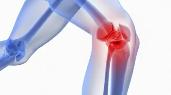 آیا دوچرخه‌ سواری به زانو آسیب می‌ زند؟ پاسخ یک فوق تخصص زانو + فیلم