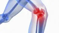 آیا دوچرخه‌ سواری به زانو آسیب می‌ زند؟ پاسخ یک فوق تخصص زانو + فیلم