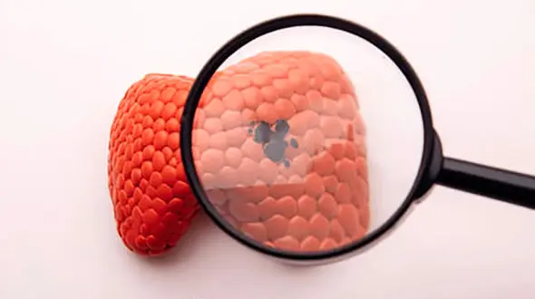 درمان کم کاری تیروئید در طب سنتی