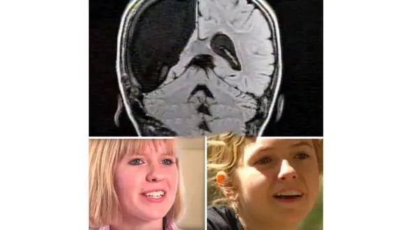 مغز این خانم دکتر نصفه است! + عکس