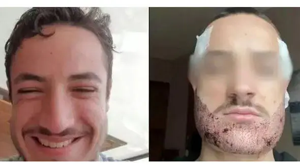 خودکشی پسر جوان بخاطر بد شدن کاشت ریش