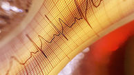 مرگ‌های ناشی از بیماری‌های قلبی رکورد کرونا را می زند