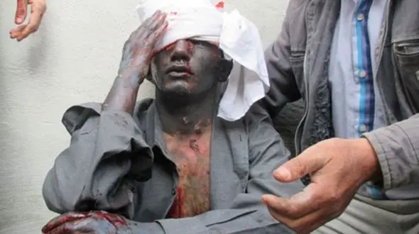  انفجار مواد محترقه در اردبیل سه تن را مصدوم کرد