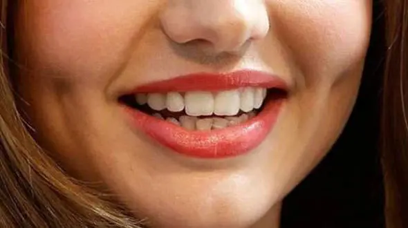 ایجاد چال گونه با بدون نیاز به جراحی