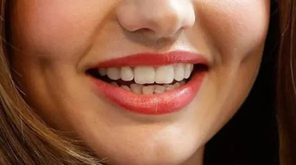 ایجاد چال گونه با بدون نیاز به جراحی