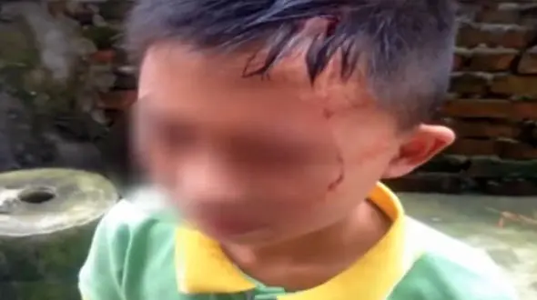 نادرترین سانحه رانندگی که نوجوانی را تا یک قدمی مرگ برد + فیلم