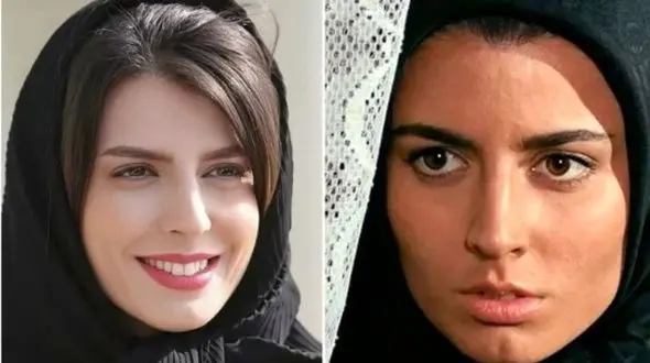 لیلا حاتمی: چندان زیبا نیستم، جراحی زیبایی انجام دادم