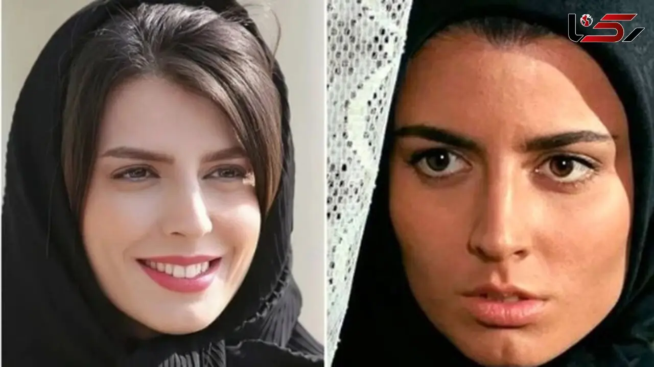 لیلا حاتمی: چندان زیبا نیستم، جراحی زیبایی انجام دادم
