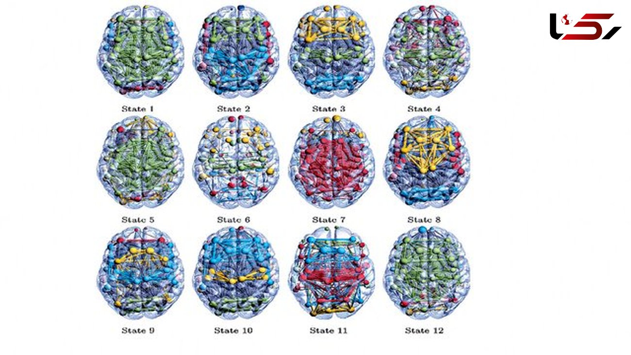 کشف ۱۲ حالت مخفی در مغز