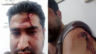 مزاحمان ناموس استاد دانشگاه را با چاقو زدند + عکس
