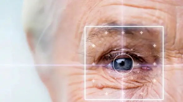 کدام مشاغل خطر پارگی شبکیه چشم را بیشتر می‌ کند؟