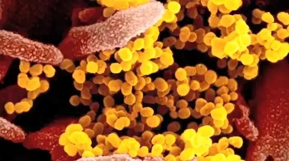 
تصاویر جدید منتشر شده از ویروس کرونا
