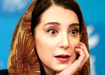 سحر جعفری جوزانی : یهویی زیبایی ام رفت /  صورتم کج شد کلا صورتم افتاد / دوبینی پیدا کردم