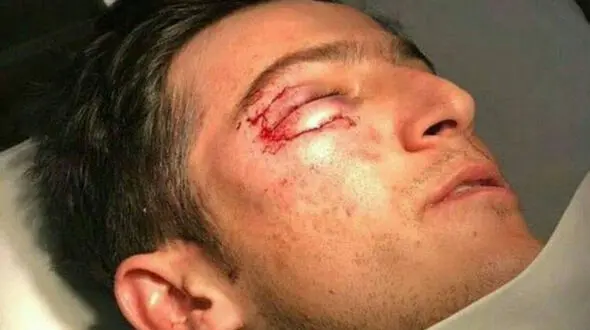 تصویر سردار آزمون بعد از عمل جراحی +عکس
