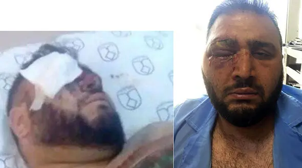 اظهارات دردناک یک پرسپولیسی که دعا می کند چشمش تخلیه نشود/ سپاهانی‌ها مانند زامبی‌ به جانم افتادند + عکس
