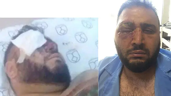اظهارات دردناک یک پرسپولیسی که دعا می کند چشمش تخلیه نشود/ سپاهانی‌ها مانند زامبی‌ به جانم افتادند + عکس
