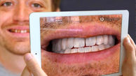 آینه مجازی لبخندتان را قبل از جراحی دندان نشان می دهد