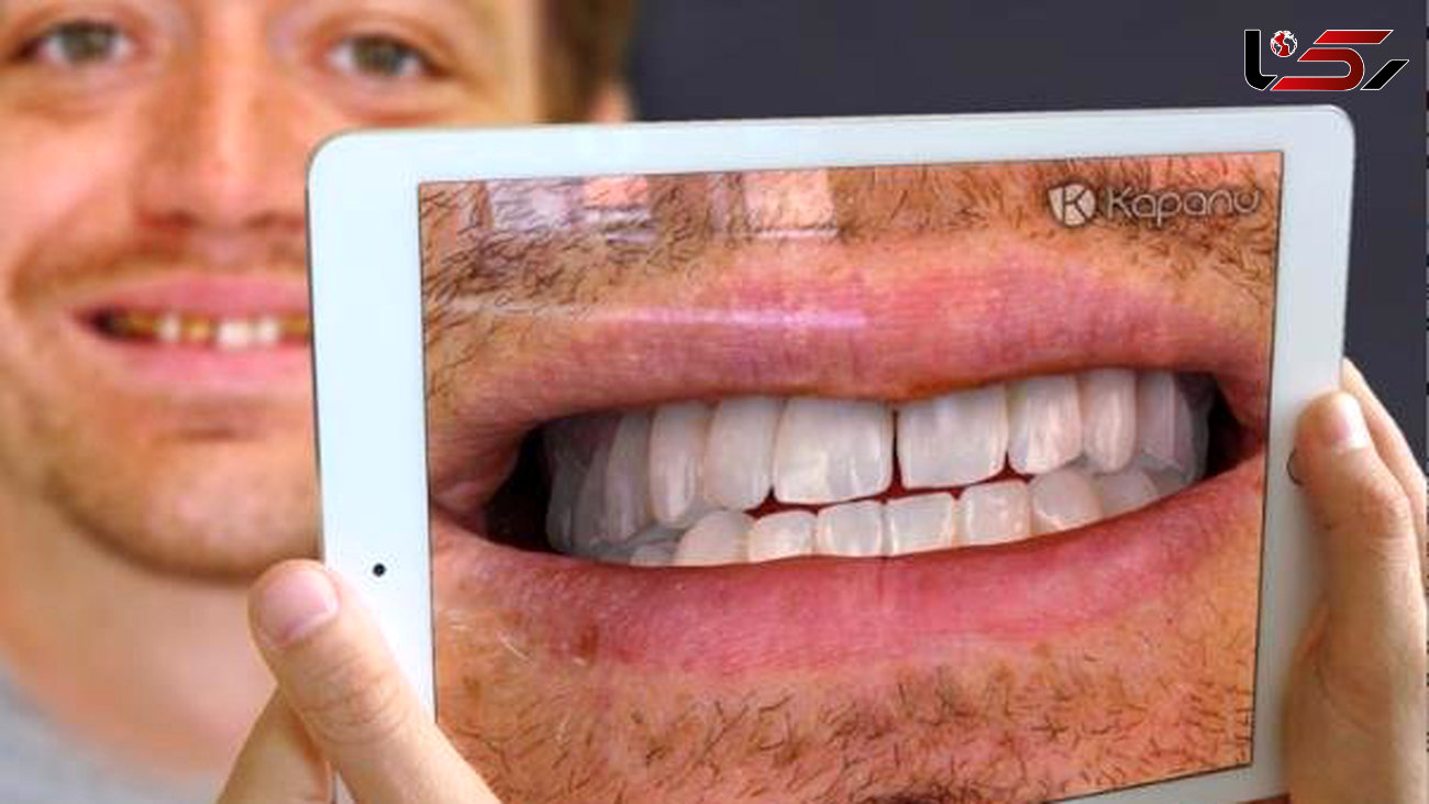 آینه مجازی لبخندتان را قبل از جراحی دندان نشان می دهد
