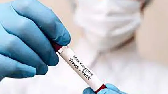 آبله میمون در مقابل کرونا؛ شباهت‌ها، تفاوت‌ها و نگرانی‌های جهانی