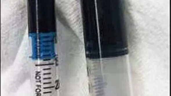 خون این زن به رنگ آبی درآمد!