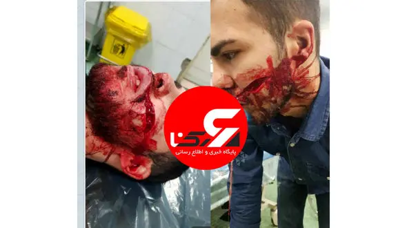 عکس از شکافته شدن صورت یک جوان تهرانی با چاقوی زورگیران خشن