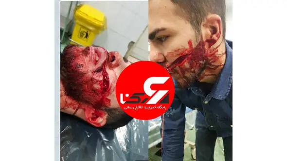 عکس از شکافته شدن صورت یک جوان تهرانی با چاقوی زورگیران خشن