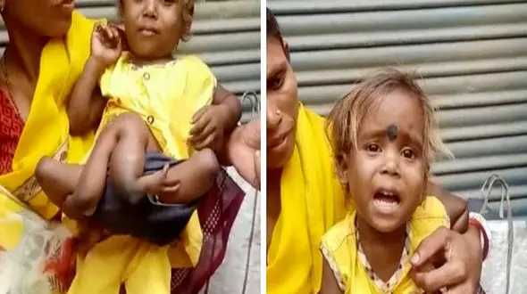 واقعی ترین دختر عنکبوتی را ببینید + عکس ها 