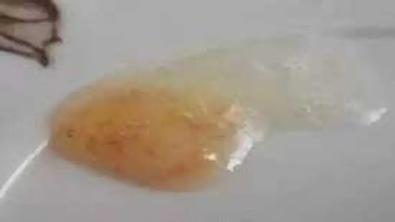 رنگ خلط گلو