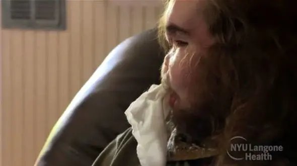 جراحی عجیب روی صورت پسر جوان که ۲۵ ساعت طول کشید+ تصاویر