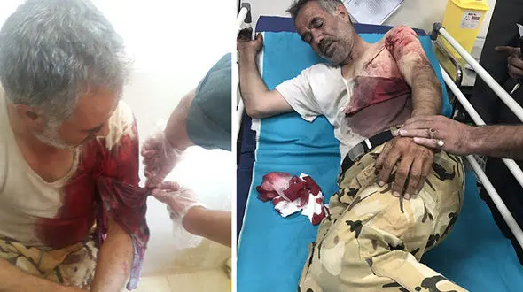 حمله پلنگ به مردی در اطراف قزوین +عکس 