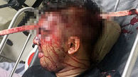 فرو رفتن میله آهنی در جمجمه احمد / او زنده ماند + عکس باورنکردنی