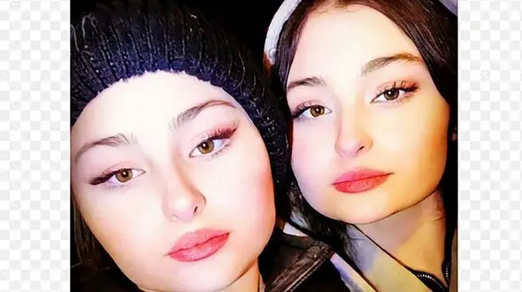 این خواهران دوقلوی ایرانی زیباتر از سارا و نیکا ! / زیبایی کدام ها طبیعی است ! + عکس ها را مقایسه کنید