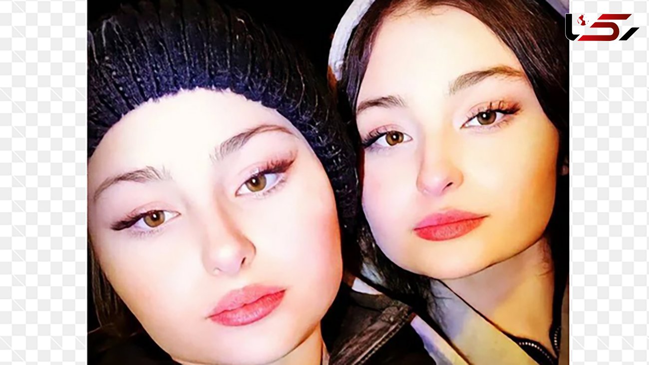 این خواهران دوقلوی ایرانی زیباتر از سارا و نیکا ! / زیبایی کدام ها طبیعی است ! + عکس ها را مقایسه کنید
