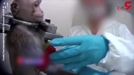 شکنجه و زجرکش کردن حیوانات برای آزمایش محصولات دارویی در آلمان + فیلم دلخراش  (14+)