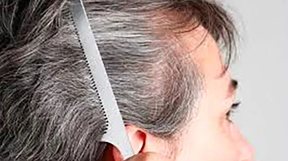 تمام عواملی که می توانند موجب سفیدی زودرس موها شوند