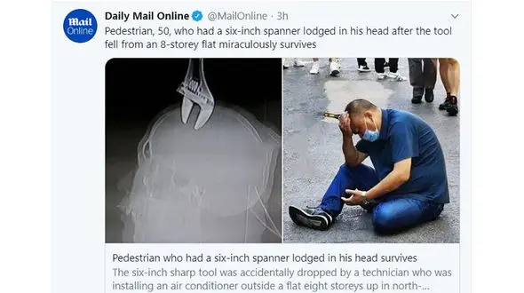 خارج کردن آچار فرانسه از سر یک مرد! + عکس