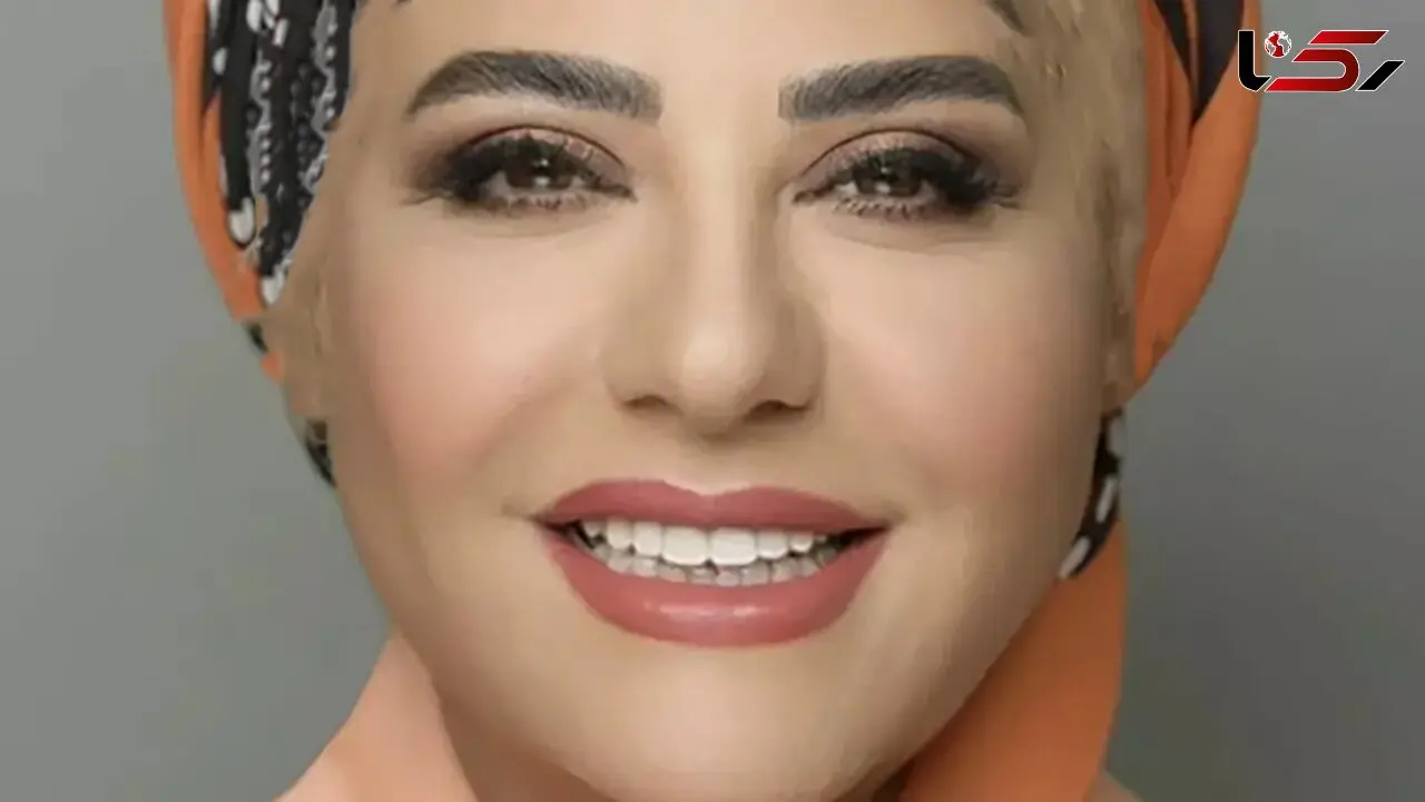 این زن زیبا کدام خانم بازیگر است ! / تغییر چهره اش او را ناشناس کرد ! + عکس های قبل و بعد